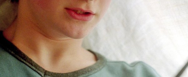 So völlig anders sieht „Harry Potter“ in anderen Ländern aus