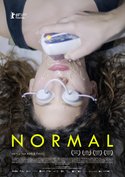 Normal